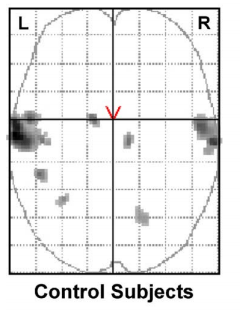 FMRI - Control Subjects